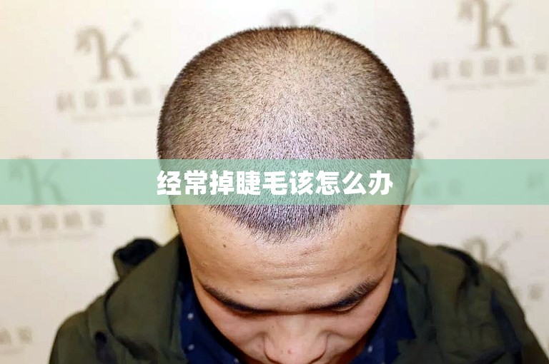 经常掉睫毛该怎么办