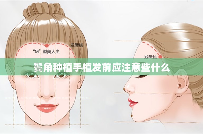 鬓角种植手植发前应注意些什么