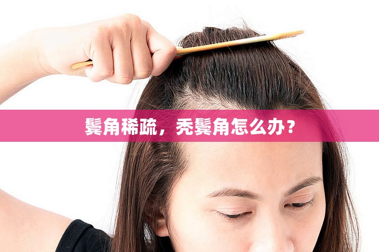 鬓角稀疏,秃鬓角怎么办? 鬓角稀疏,秃鬓角怎么办?