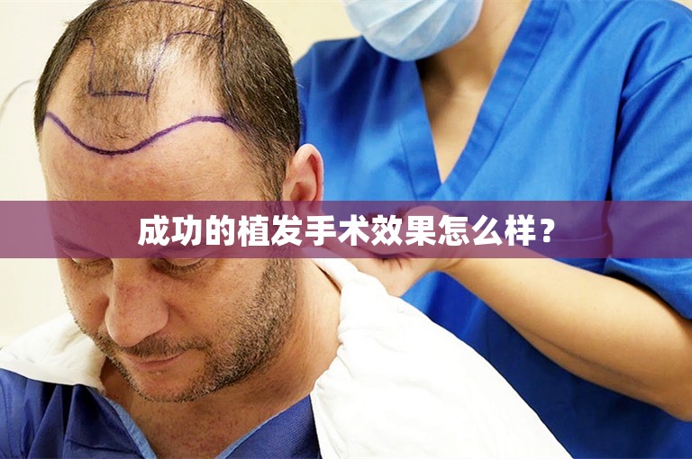 成功的植发手术效果怎么样？