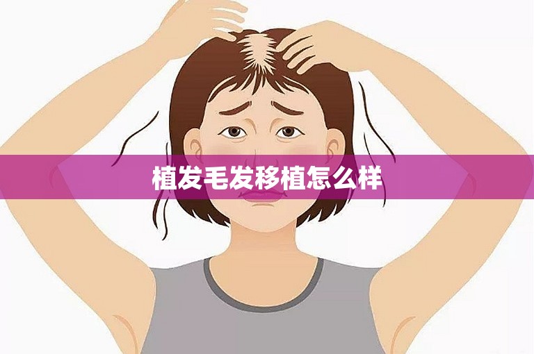 植发毛发移植怎么样