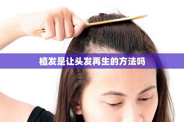 植发是让头发再生的方法吗