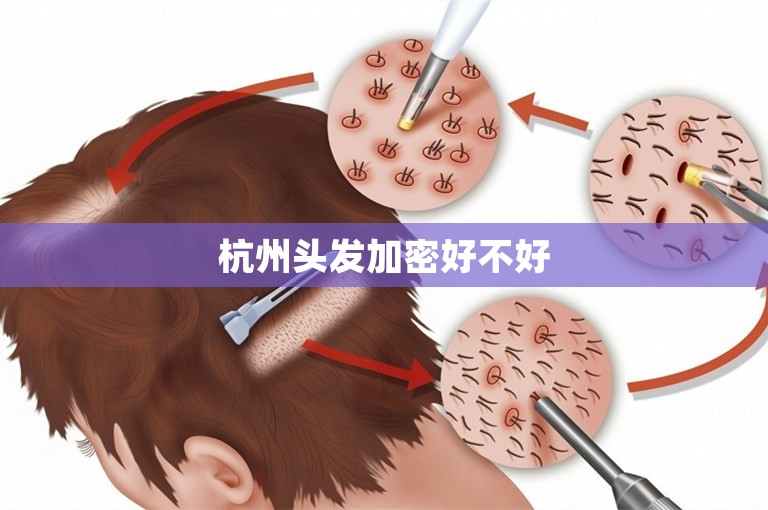 杭州头发加密好不好