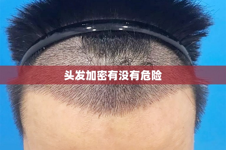 头发加密有没有危险