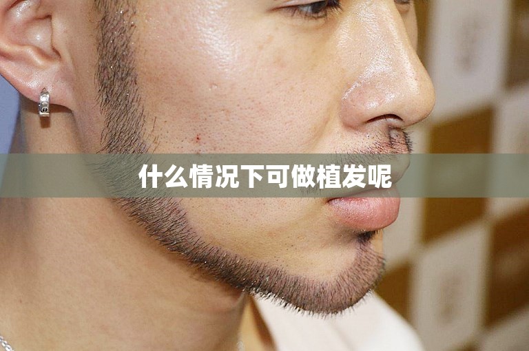 什么情况下可做植发呢
