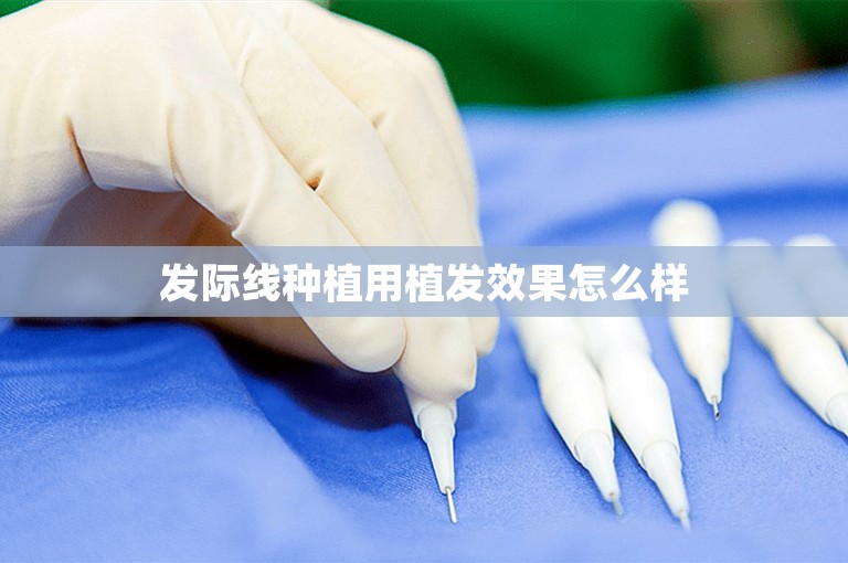 发际线种植用植发效果怎么样