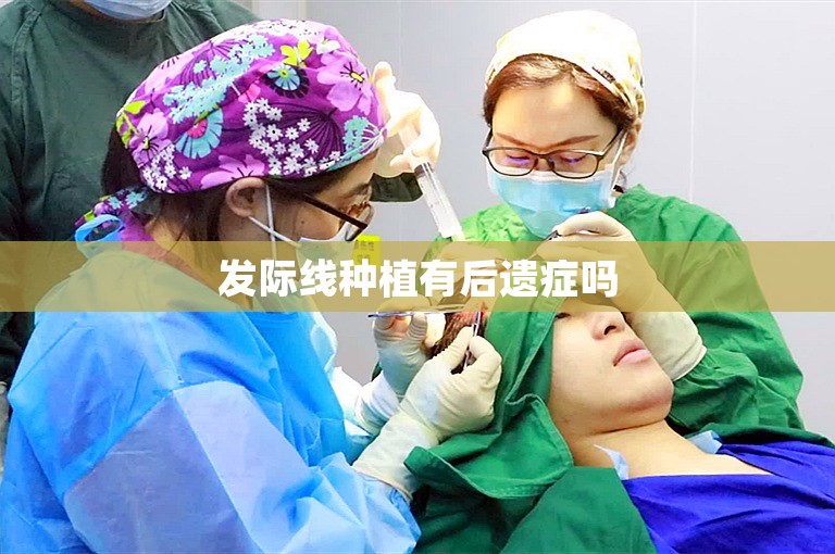 发际线种植有后遗症吗 发际线种植有后遗症吗