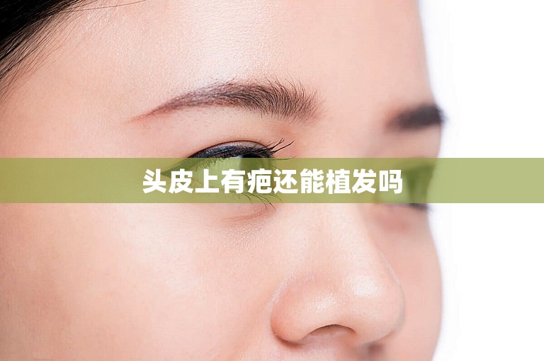 头皮上有疤还能植发吗