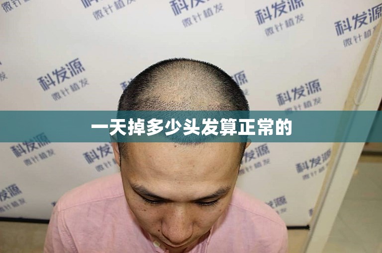 一天掉多少头发算正常的