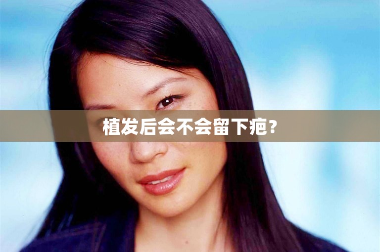 植发后会不会留下疤？