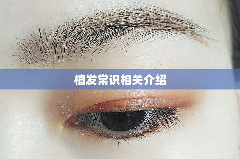 植发常识相关介绍