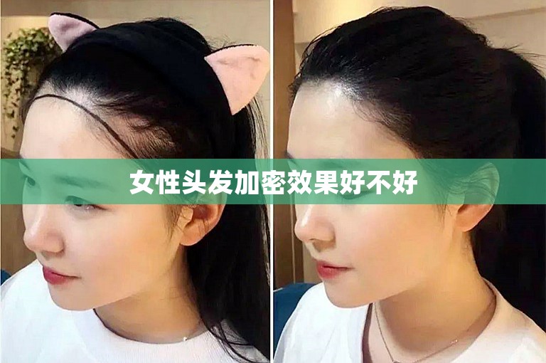 女性头发加密效果好不好