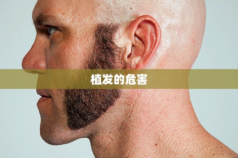 植发的危害