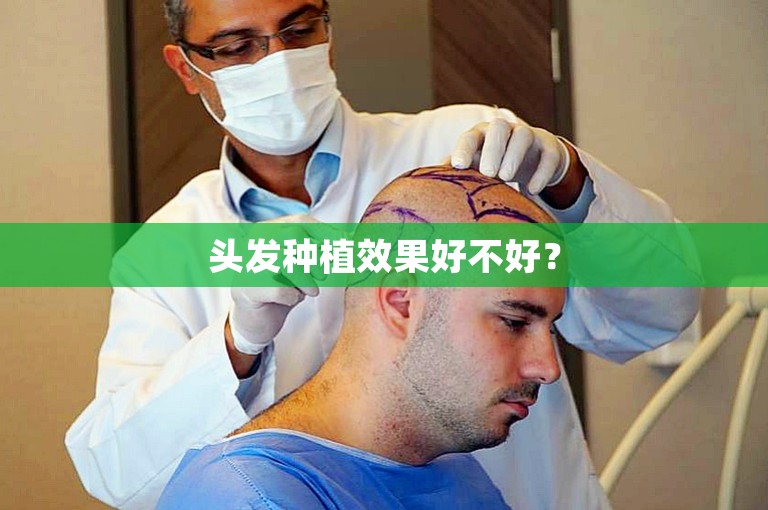 头发种植效果好不好？