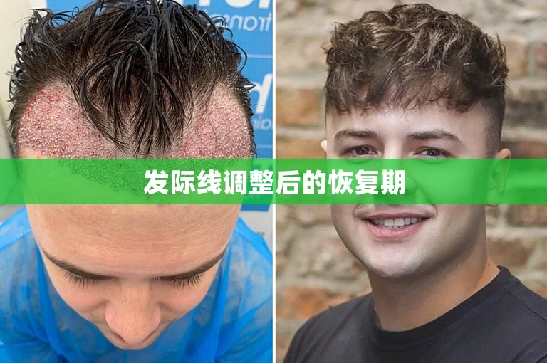 发际线调整后的恢复期