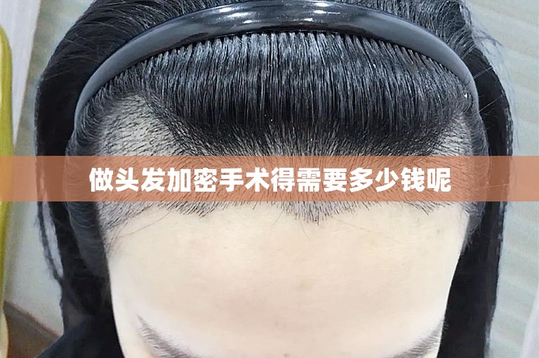 做头发加密手术得需要多少钱呢