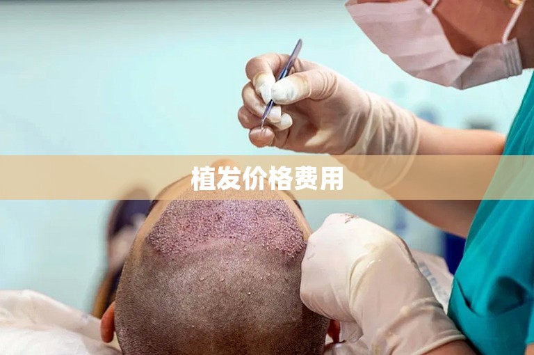 植发价格费用