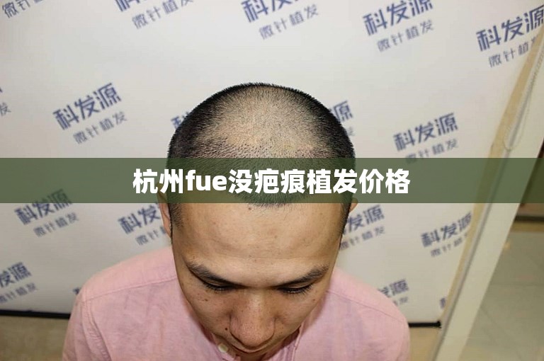 杭州fue没疤痕植发价格
