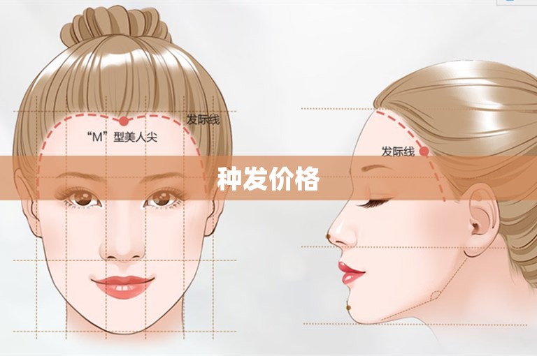 种发价格