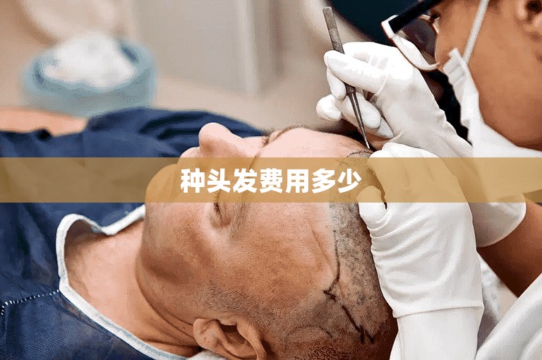 种头发费用多少