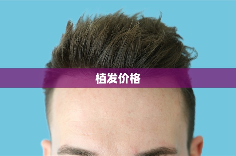 植发价格
