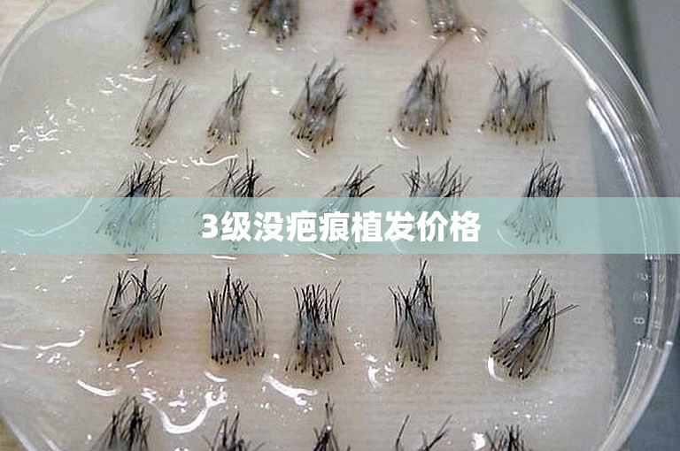 3级没疤痕植发价格