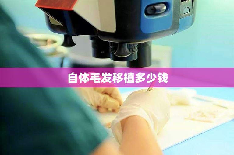 自体毛发移植多少钱