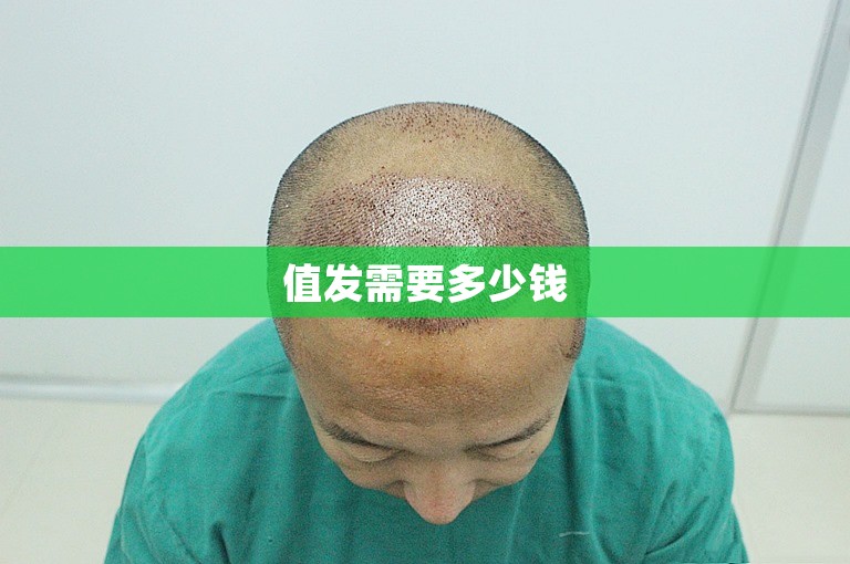 值发需要多少钱