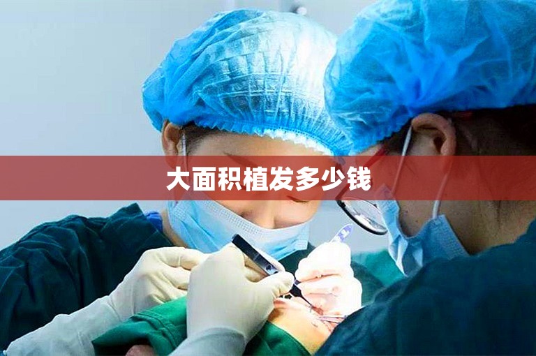 大面积植发多少钱