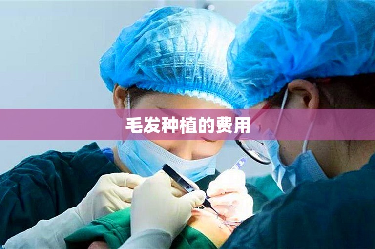 毛发种植的费用