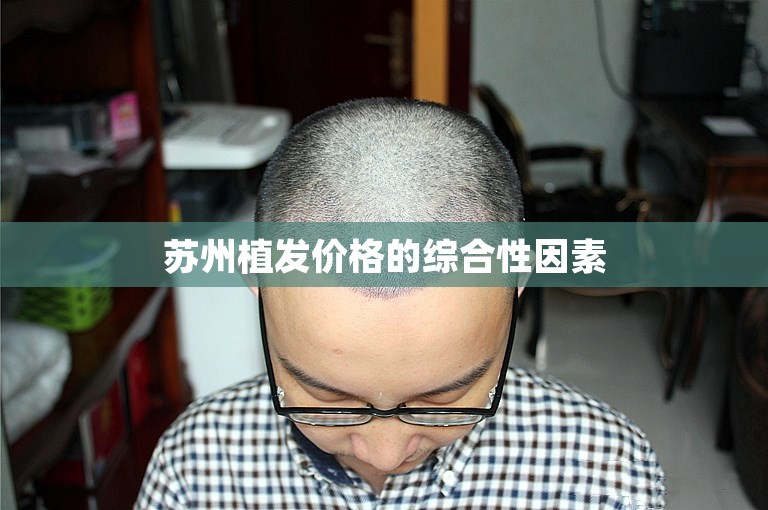 苏州植发价格的综合性因素