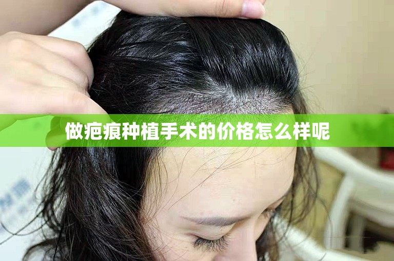 做疤痕种植手术的价格怎么样呢