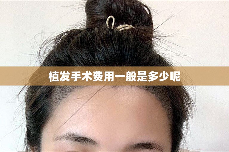 植发手术费用一般是多少呢