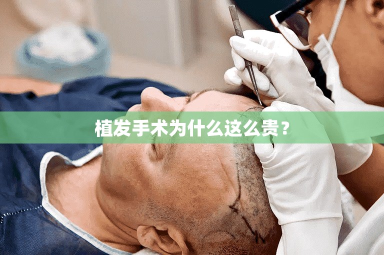 植发手术为什么这么贵？