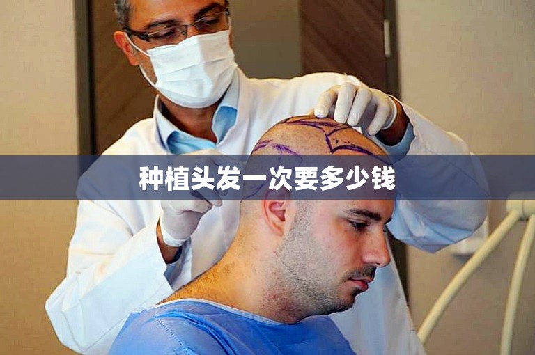 种植头发一次要多少钱