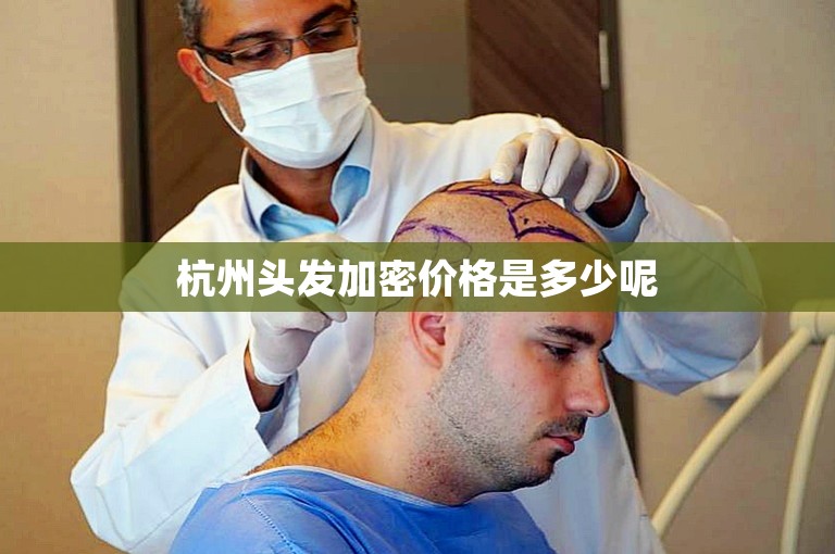 杭州头发加密价格是多少呢