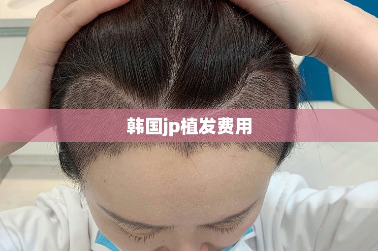 韩国jp植发费用