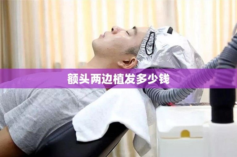 额头两边植发多少钱 额头两边植发多少钱