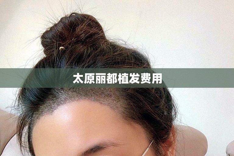 太原丽都植发费用