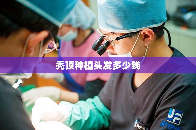 秃顶种植头发多少钱