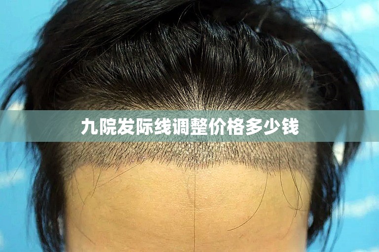 九院发际线调整价格多少钱