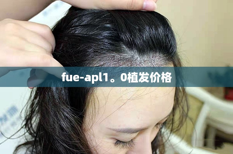 fue-apl1。0植发价格 fue-apl1。0植发价格