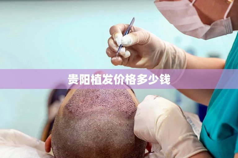 贵阳植发价格多少钱