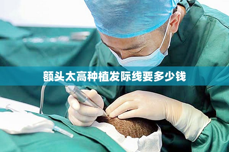 额头太高种植发际线要多少钱 额头太高种植发际线要多少钱