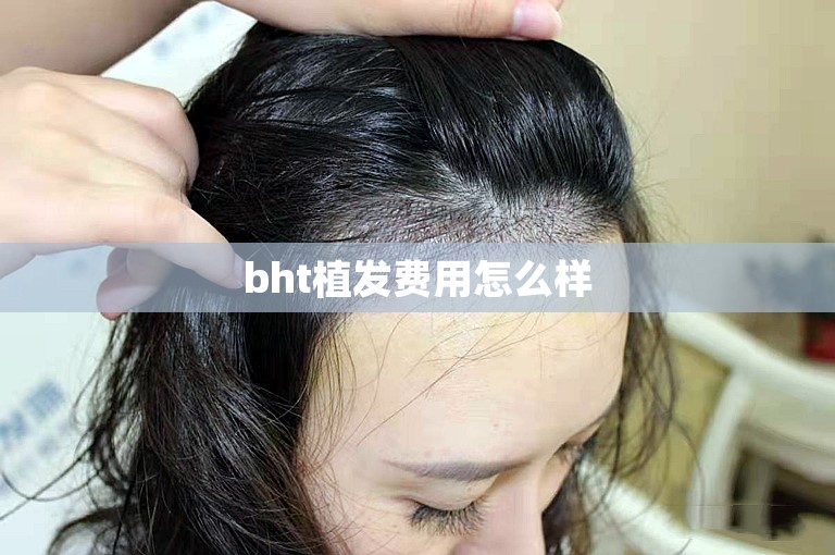 bht植发费用怎么样 bht植发费用怎么样