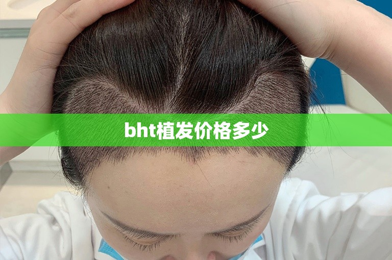 bht植发价格多少 bht植发价格多少