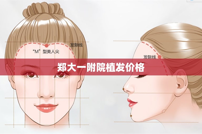郑大一附院植发价格