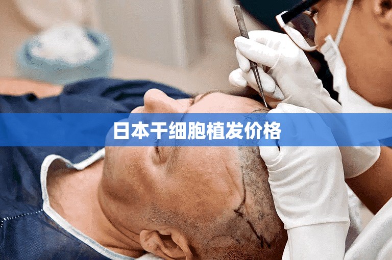 日本干细胞植发价格
