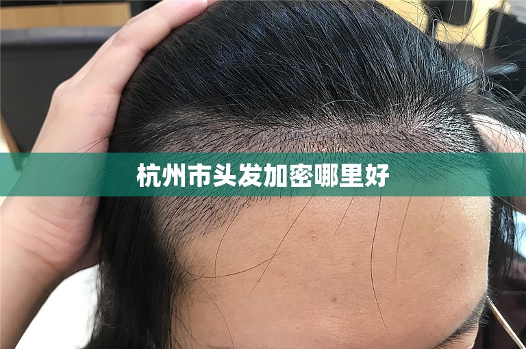 杭州市头发加密哪里好