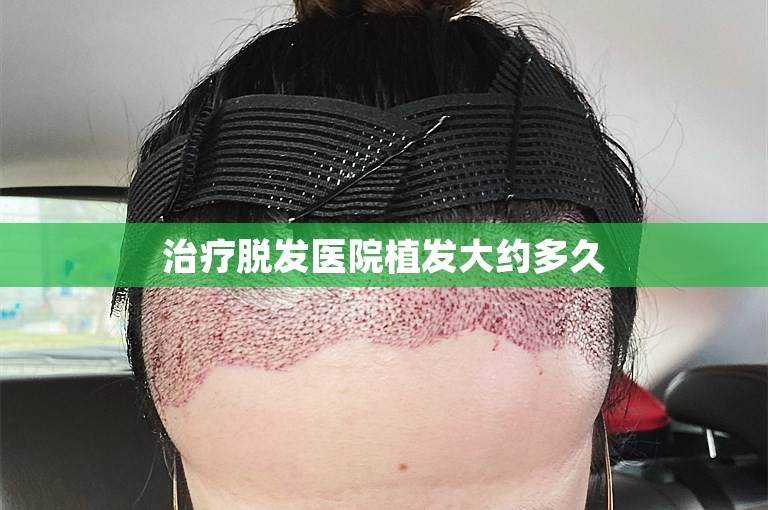 治疗脱发医院植发大约多久